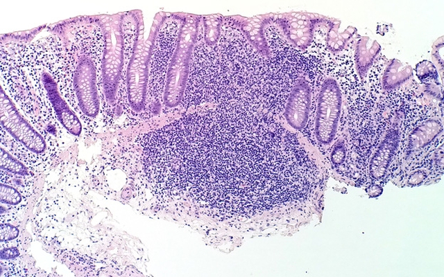 Lumia-Microscope-shot