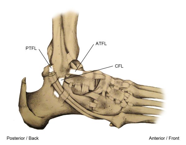 Sprain Figure Ankle Sprain Figure 2 – BMS | Bachelor of Management Studies Unofficial ...