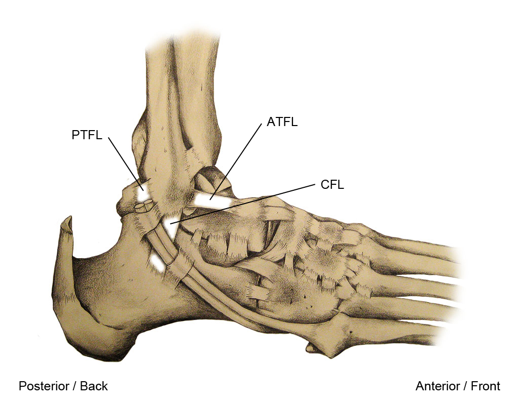 Know Ankle Sprain: Cure and Remedy.