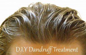 Dandruff-Treatment018